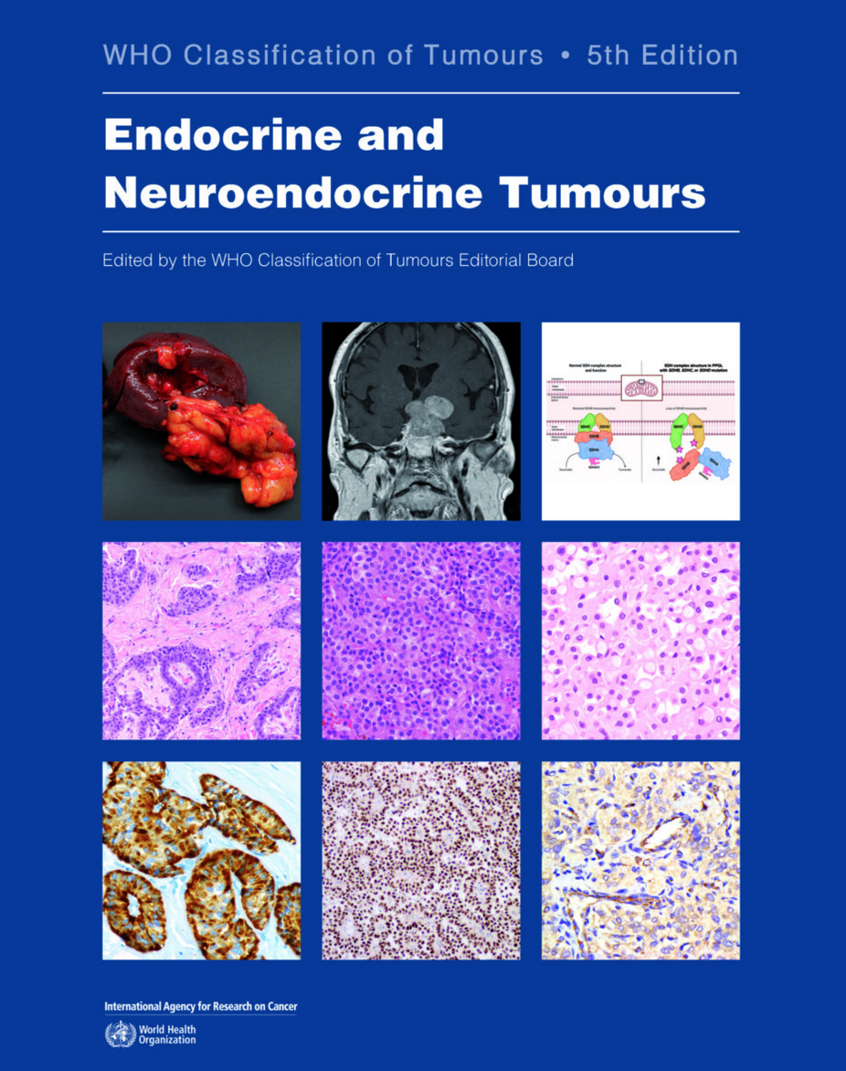 Endocrine and Neuroendocrine Tumours